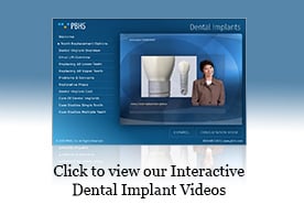 Dental Implant Procedure in Aubrey, TX